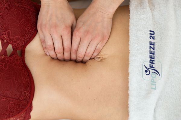 diastasis recti treatment South Woodford