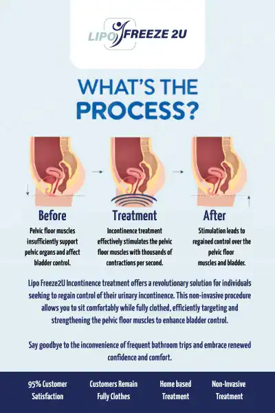 Diagram of how incontinence treatment South Woodford works.