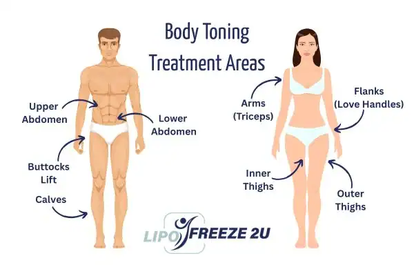 Graphic showing where you can have Body toning Treatment South Woodford on your body