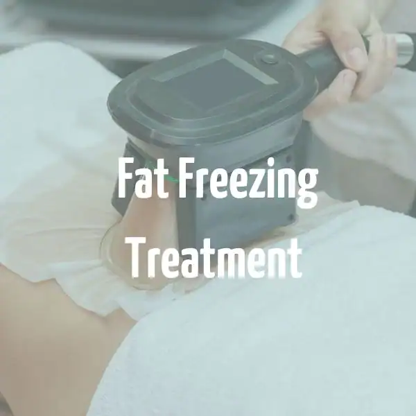 fat freezing treatment South Woodford